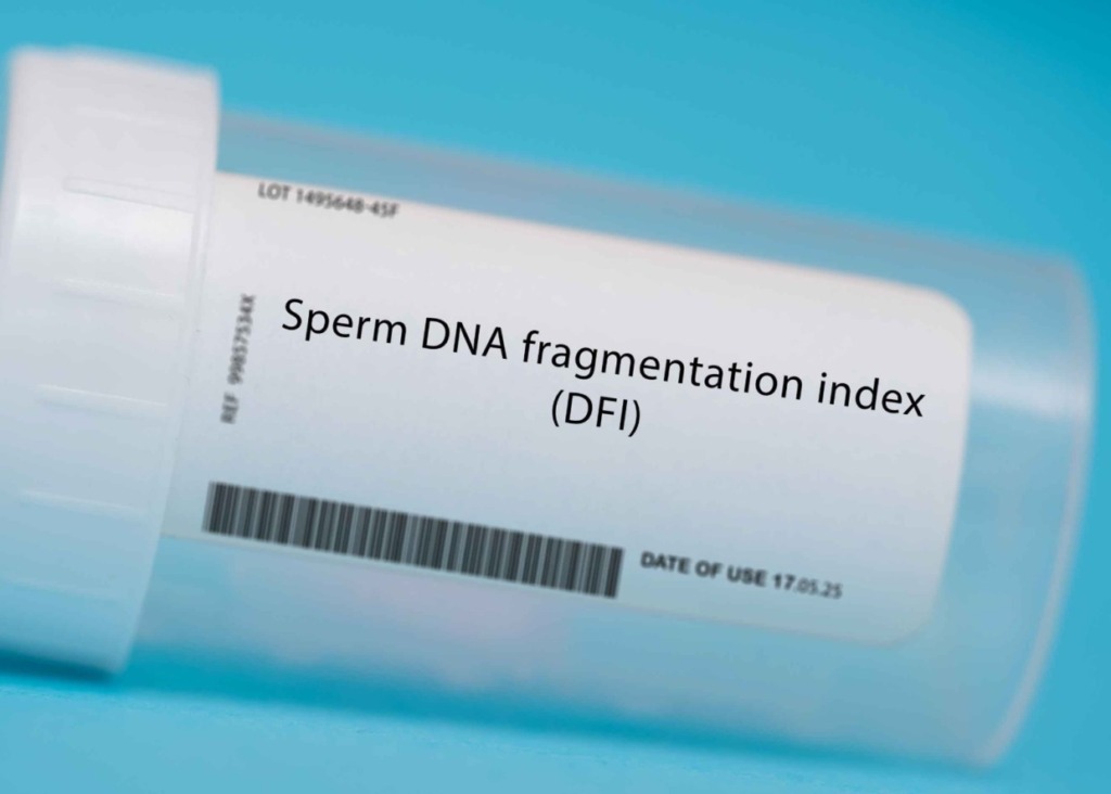 Sperm testing